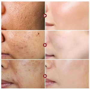 White Rice Whitening Face Serum Wrinkle Remove Fine Lines Cream Shrink Pores Fade Dull Melanin Moisturize Brighten Skin Care Set - Image 2